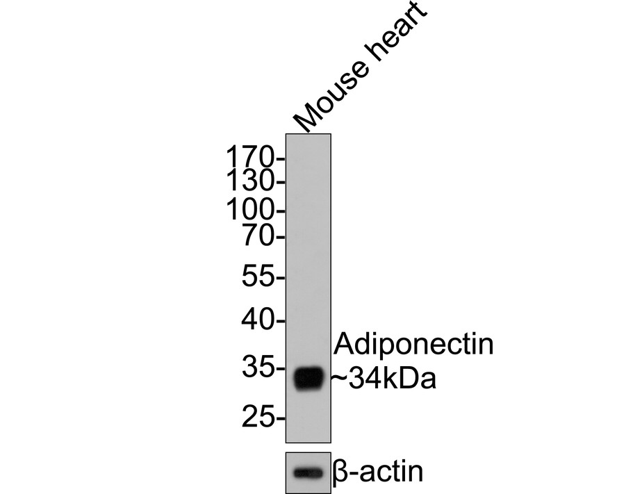 Western blot analysis of Adiponectin on mouse heart tissue lysates with Rabbit anti-Adiponectin antibody (HA721064) at 1/500 dilution.<br />
<br />
Lysates/proteins at 20 µg/Lane.<br />
<br />
Predicted band size: 27 kDa<br />
Observed band size: 34 kDa<br />
<br />
Exposure time: 1 minute;<br />
<br />
10% SDS-PAGE gel.<br />
<br />
Proteins were transferred to a PVDF membrane and blocked with 5% NFDM/TBST for 1 hour at room temperature. The primary antibody (HA721064) at 1/500 dilution was used in 5% NFDM/TBST at room temperature for 2 hours. Goat Anti-Rabbit IgG - HRP Secondary Antibody (HA1001) at 1:300,000 dilution was used for 1 hour at room temperature.