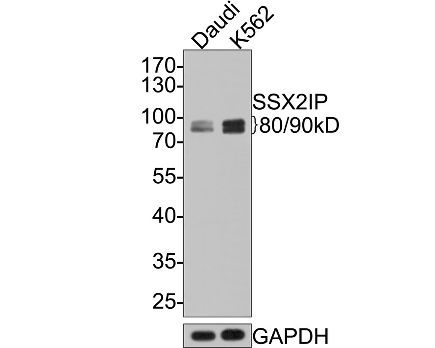 Western blot analysis of SSX2IP on different lysates with Rabbit anti-SSX2IP antibody (HA721065) at 1/500 dilution.<br />
<br />
Lane 1: Daudi cell lysate<br />
Lane 2: K562 cell lysate<br />
<br />
Lysates/proteins at 10 µg/Lane.<br />
<br />
Predicted band size: 71 kDa<br />
Observed band size: 80/90 kDa<br />
<br />
Exposure time: 2 minutes;<br />
<br />
10% SDS-PAGE gel.<br />
<br />
Proteins were transferred to a PVDF membrane and blocked with 5% NFDM/TBST for 1 hour at room temperature. The primary antibody (HA721065) at 1/500 dilution was used in 5% NFDM/TBST at room temperature for 2 hours. Goat Anti-Rabbit IgG - HRP Secondary Antibody (HA1001) at 1:300,000 dilution was used for 1 hour at room temperature.