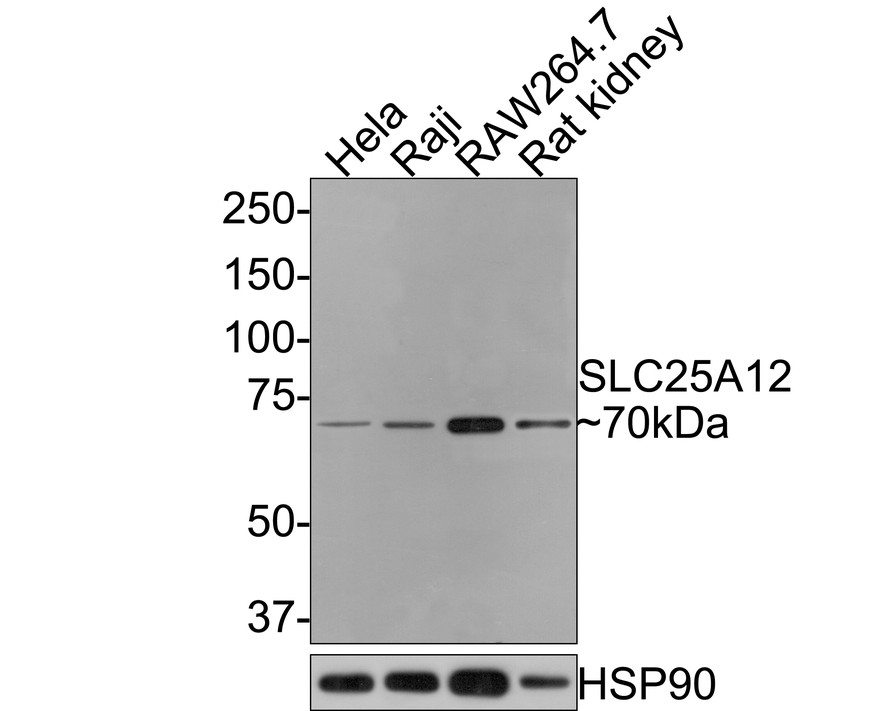 Western blot analysis of SLC25A12 on different lysates with Rabbit anti-SLC25A12 antibody (HA721066) at 1/500 dilution.<br />
<br />
Lane 1: Hela cell lysate<br />
Lane 2: Raji cell lysate<br />
Lane 3: RAW264.7 cell lysate<br />
Lane 4: Rat kidney tissue lysate (20 µg/Lane)<br />
<br />
Lysates/proteins at 10 µg/Lane.<br />
<br />
Predicted band size: 75 kDa<br />
Observed band size: 70 kDa<br />
<br />
Exposure time: 2 minutes;<br />
<br />
8% SDS-PAGE gel.<br />
<br />
Proteins were transferred to a PVDF membrane and blocked with 5% NFDM/TBST for 1 hour at room temperature. The primary antibody (HA721066) at 1/500 dilution was used in 5% NFDM/TBST at room temperature for 2 hours. Goat Anti-Rabbit IgG - HRP Secondary Antibody (HA1001) at 1:300,000 dilution was used for 1 hour at room temperature.