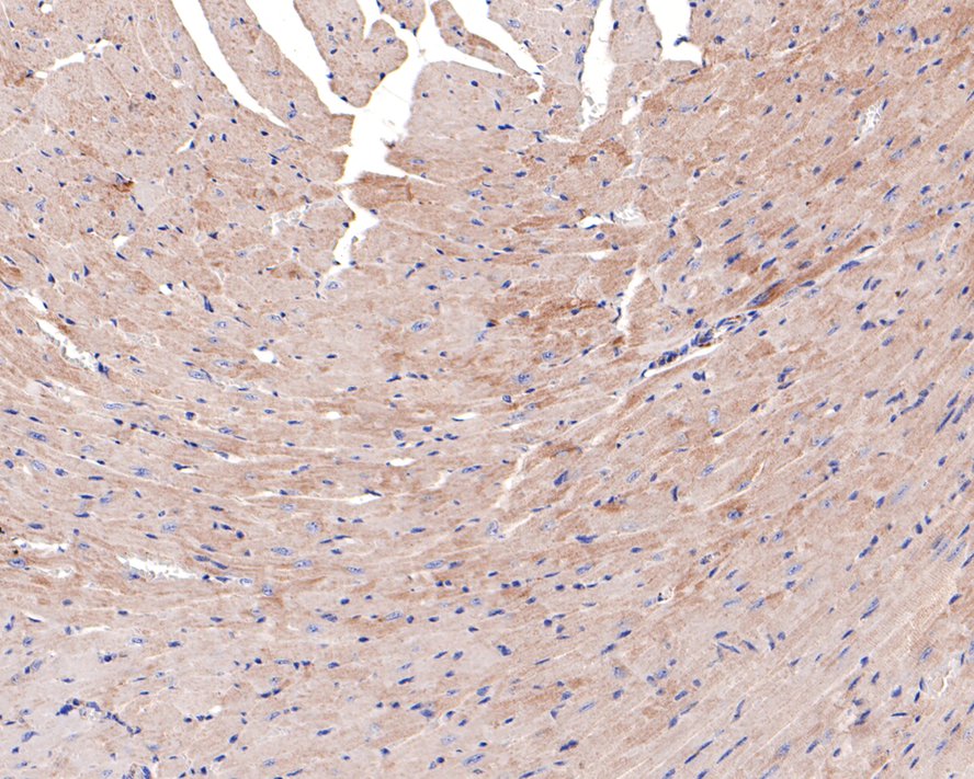 Immunohistochemical analysis of paraffin-embedded mouse heart tissue with Rabbit anti-SLC25A12 antibody (HA721066) at 1/100 dilution.<br />
<br />
The section was pre-treated using heat mediated antigen retrieval with Tris-EDTA buffer (pH 9.0) for 20 minutes. The tissues were blocked in 1% BSA for 20 minutes at room temperature, washed with ddH2O and PBS, and then probed with the primary antibody (HA721066) at 1/100 dilution for 1 hour at room temperature. The detection was performed using an HRP conjugated compact polymer system. DAB was used as the chromogen. Tissues were counterstained with hematoxylin and mounted with DPX.