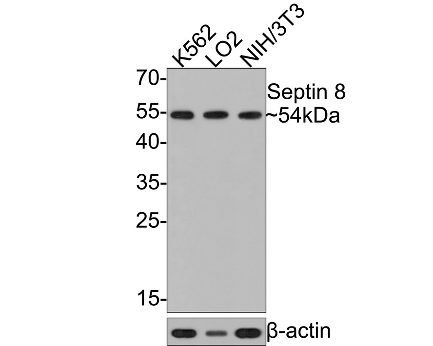 Western blot analysis of Septin 8 on different lysates with Rabbit anti-Septin 8 antibody (HA721055) at 1/500 dilution.<br />
<br />
Lane 1: K562 cell lysate<br />
Lane 2: LO2 cell lysate<br />
Lane 3: NIH/3T3 cell lysate<br />
<br />
Lysates/proteins at 10 µg/Lane.<br />
<br />
Predicted band size: 56 kDa<br />
Observed band size: 54 kDa<br />
<br />
Exposure time: 1 minute;<br />
<br />
12% SDS-PAGE gel.<br />
<br />
Proteins were transferred to a PVDF membrane and blocked with 5% NFDM/TBST for 1 hour at room temperature. The primary antibody (HA721055) at 1/500 dilution was used in 5% NFDM/TBST at room temperature for 2 hours. Goat Anti-Rabbit IgG - HRP Secondary Antibody (HA1001) at 1:300,000 dilution was used for 1 hour at room temperature.