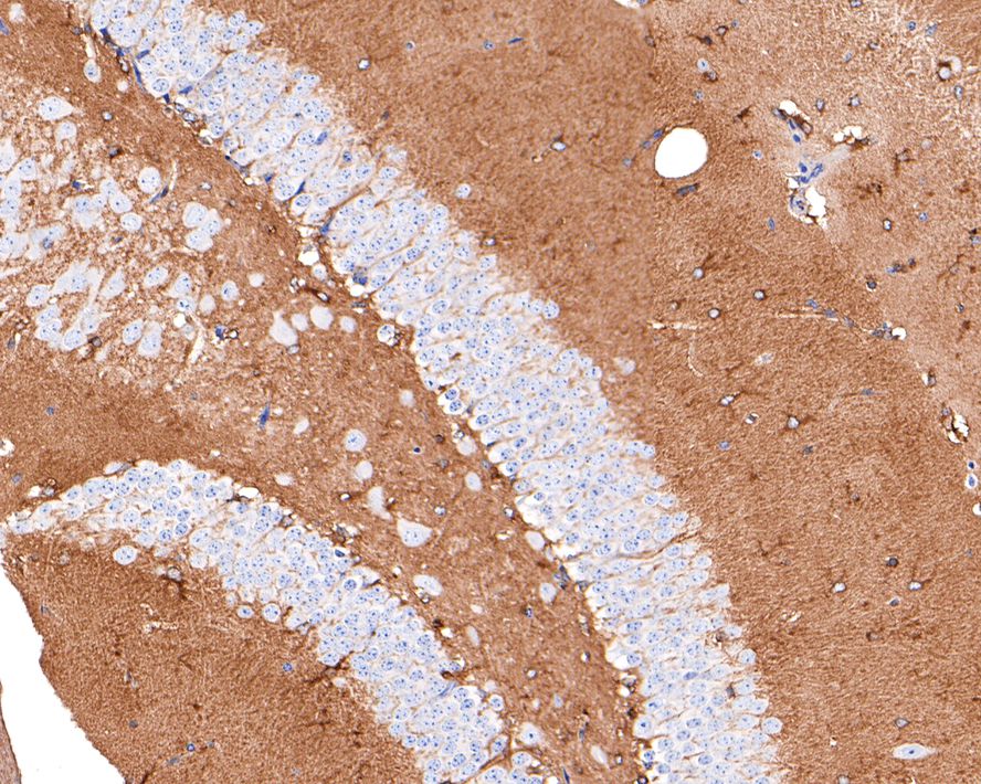 Immunohistochemical analysis of paraffin-embedded mouse hippocampus tissue with Rabbit anti-Septin 8 antibody (HA721055) at 1/400 dilution.<br />
<br />
The section was pre-treated using heat mediated antigen retrieval with Tris-EDTA buffer (pH 9.0) for 20 minutes. The tissues were blocked in 1% BSA for 20 minutes at room temperature, washed with ddH2O and PBS, and then probed with the primary antibody (HA721055) at 1/400 dilution for 1 hour at room temperature. The detection was performed using an HRP conjugated compact polymer system. DAB was used as the chromogen. Tissues were counterstained with hematoxylin and mounted with DPX.