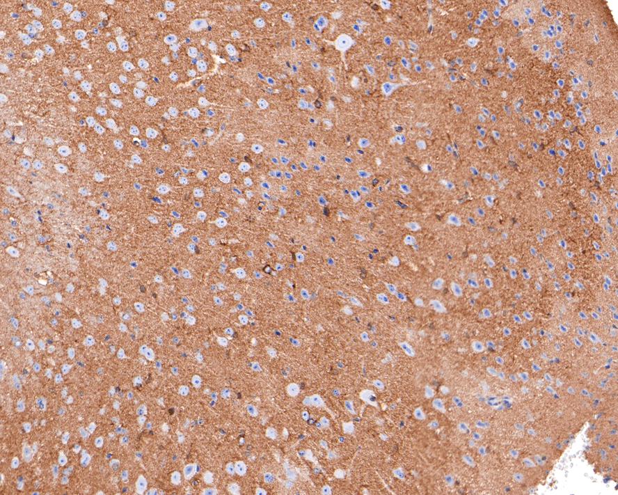 Immunohistochemical analysis of paraffin-embedded mouse brain tissue with Rabbit anti-Septin 8 antibody (HA721055) at 1/400 dilution.<br />
<br />
The section was pre-treated using heat mediated antigen retrieval with Tris-EDTA buffer (pH 9.0) for 20 minutes. The tissues were blocked in 1% BSA for 20 minutes at room temperature, washed with ddH2O and PBS, and then probed with the primary antibody (HA721055) at 1/400 dilution for 1 hour at room temperature. The detection was performed using an HRP conjugated compact polymer system. DAB was used as the chromogen. Tissues were counterstained with hematoxylin and mounted with DPX.