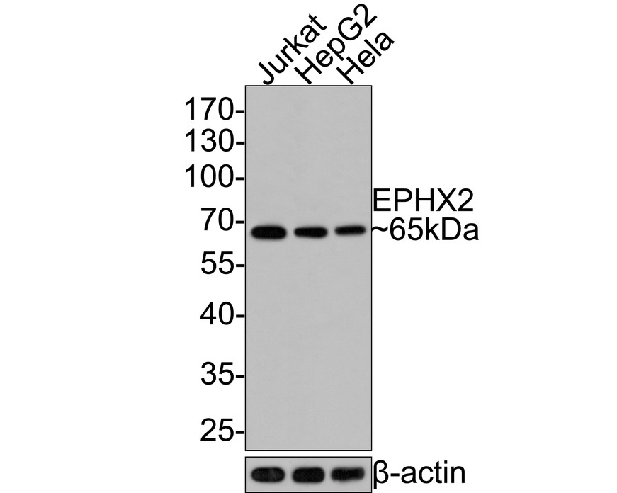 Western blot analysis of EPHX2 on different lysates with Rabbit anti-EPHX2 antibody (HA721056) at 1/500 dilution.<br />
<br />
Lane 1: Jurkat cell lysate<br />
Lane 2: HepG2cell lysate<br />
Lane 3: Hela cell lysate<br />
<br />
Lysates/proteins at 10 µg/Lane.<br />
<br />
Predicted band size: 63 kDa<br />
Observed band size: 65 kDa<br />
<br />
Exposure time: 30 seconds;<br />
<br />
10% SDS-PAGE gel.<br />
<br />
Proteins were transferred to a PVDF membrane and blocked with 5% NFDM/TBST for 1 hour at room temperature. The primary antibody (HA721056) at 1/500 dilution was used in 5% NFDM/TBST at room temperature for 2 hours. Goat Anti-Rabbit IgG - HRP Secondary Antibody (HA1001) at 1:300,000 dilution was used for 1 hour at room temperature.