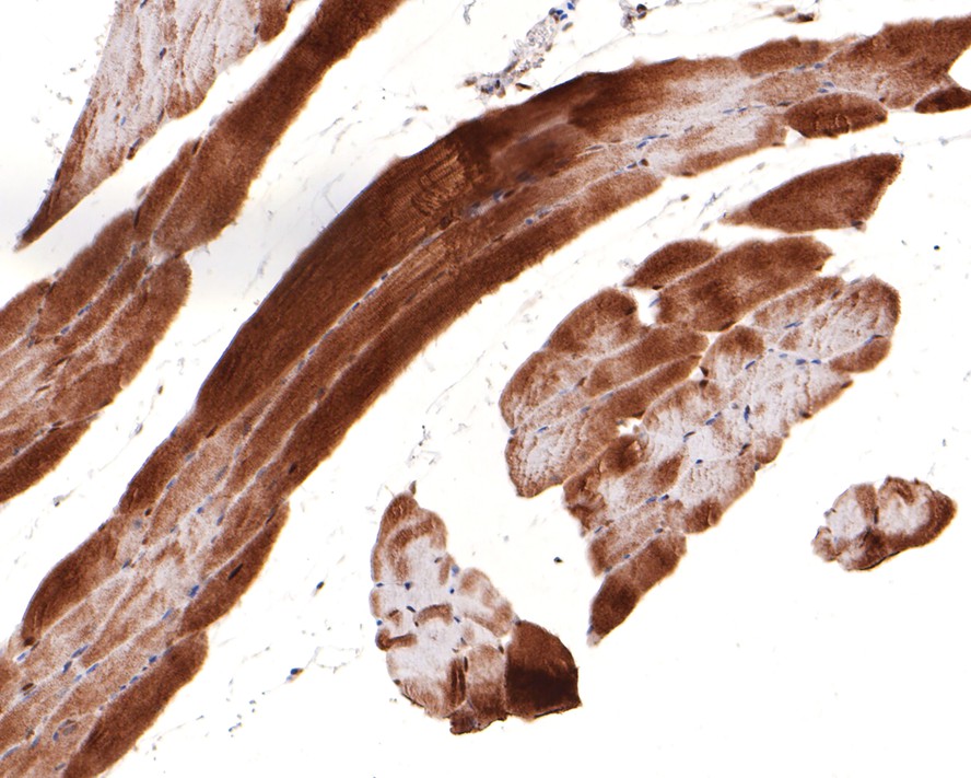 Immunohistochemical analysis of paraffin-embedded rat skeletal muscle tissue with Rabbit anti-UFD1L antibody (HA721057) at 1/100 dilution.<br />
<br />
The section was pre-treated using heat mediated antigen retrieval with sodium citrate buffer (pH 6.0) for 2 minutes. The tissues were blocked in 1% BSA for 20 minutes at room temperature, washed with ddH2O and PBS, and then probed with the primary antibody (HA721057) at 1/100 dilution for 1 hour at room temperature. The detection was performed using an HRP conjugated compact polymer system. DAB was used as the chromogen. Tissues were counterstained with hematoxylin and mounted with DPX.