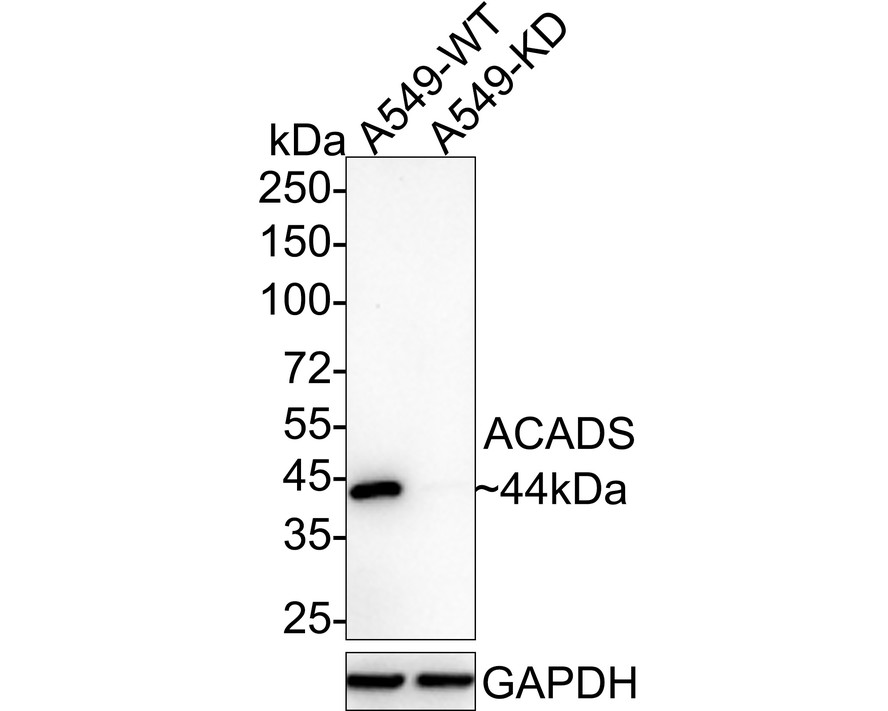 Western blot analysis of ACADS on different lysates with Rabbit anti-ACADS antibody (HA721058) at 1/500 dilution.<br />
<br />
Lane 1: Hela cell lysate<br />
Lane 2: 293T cell lysate<br />
<br />
Lysates/proteins at 10 µg/Lane.<br />
<br />
Predicted band size: 44 kDa<br />
Observed band size: 39 kDa<br />
<br />
Exposure time: 2 minutes;<br />
<br />
12% SDS-PAGE gel.<br />
<br />
Proteins were transferred to a PVDF membrane and blocked with 5% NFDM/TBST for 1 hour at room temperature. The primary antibody (HA721058) at 1/500 dilution was used in 5% NFDM/TBST at room temperature for 2 hours. Goat Anti-Rabbit IgG - HRP Secondary Antibody (HA1001) at 1:300,000 dilution was used for 1 hour at room temperature.