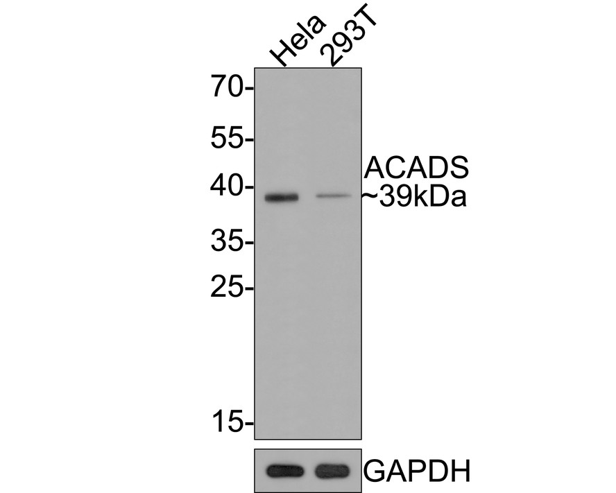 Western blot analysis of ACADS on different lysates with Rabbit anti-ACADS antibody (HA721058) at 1/1,000 dilution.<br />
<br />
Lane 1: Mouse liver tissue lysate<br />
Lane 2: Rat kidney tissue lysate<br />
<br />
Lysates/proteins at 20 µg/Lane.<br />
<br />
Predicted band size: 44 kDa<br />
Observed band size: 39 kDa<br />
<br />
Exposure time: 30 seconds;<br />
<br />
12% SDS-PAGE gel.<br />
<br />
Proteins were transferred to a PVDF membrane and blocked with 5% NFDM/TBST for 1 hour at room temperature. The primary antibody (HA721058) at 1/1,000 dilution was used in 5% NFDM/TBST at room temperature for 2 hours. Goat Anti-Rabbit IgG - HRP Secondary Antibody (HA1001) at 1:300,000 dilution was used for 1 hour at room temperature.