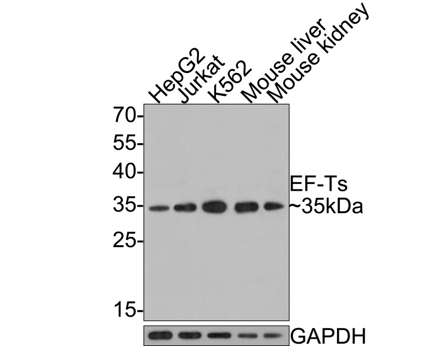 Western blot analysis of EF-Ts on different lysates with Rabbit anti-EF-Ts antibody (HA721059) at 1/500 dilution.<br />
<br />
Lane 1: HepG2 cell lysate, 10 µg/Lane<br />
Lane 2: Jurkat cell lysate, 10 µg/Lane<br />
Lane 3: K562 cell lysate, 10 µg/Lane<br />
Lane 4: Mouse liver tissue lysate, 20 µg/Lane<br />
Lane 5: Mouse kidney tissue lysate, 20 µg/Lane<br />
<br />
Predicted band size: 35 kDa<br />
Observed band size: 35 kDa<br />
<br />
Exposure time: 1 minute;<br />
<br />
12% SDS-PAGE gel.<br />
<br />
Proteins were transferred to a PVDF membrane and blocked with 5% NFDM/TBST for 1 hour at room temperature. The primary antibody (HA721059) at 1/500 dilution was used in 5% NFDM/TBST at room temperature for 2 hours. Goat Anti-Rabbit IgG - HRP Secondary Antibody (HA1001) at 1:300,000 dilution was used for 1 hour at room temperature.