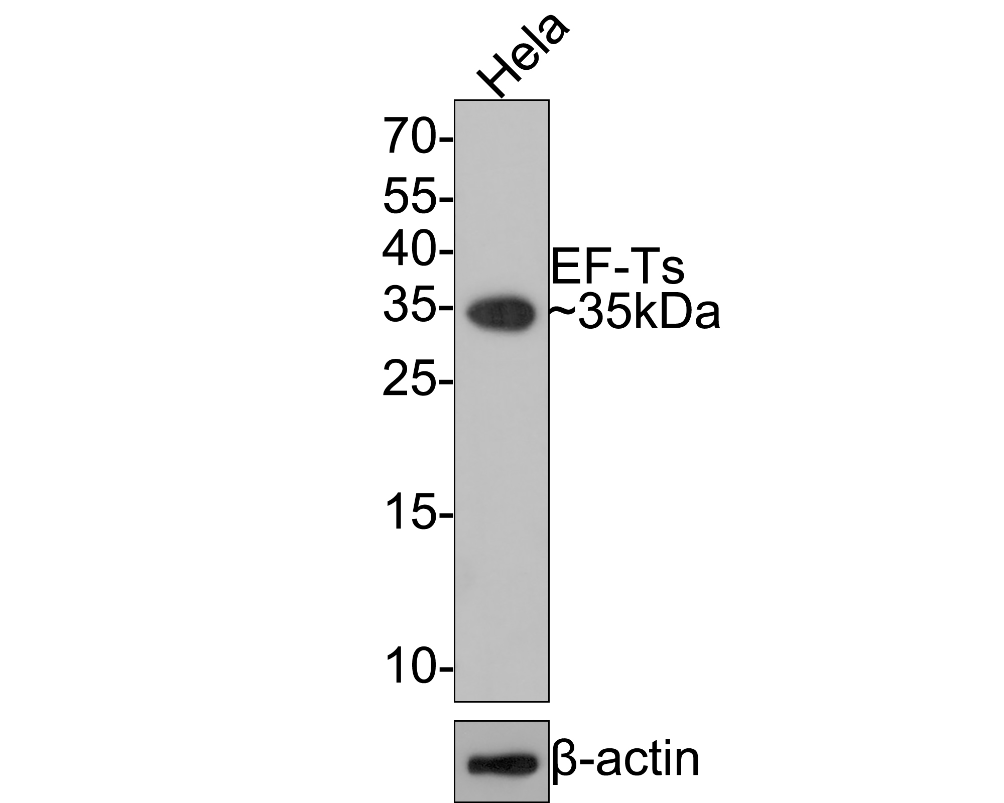 Western blot analysis of EF-Ts on Hela cell lysates with Rabbit anti-EF-Ts antibody (HA721059) at 1/500 dilution.<br />
<br />
Lysates/proteins at 10 µg/Lane.<br />
<br />
Predicted band size: 35 kDa<br />
Observed band size: 35 kDa<br />
<br />
Exposure time: 1 minute;<br />
<br />
15% SDS-PAGE gel.<br />
<br />
Proteins were transferred to a PVDF membrane and blocked with 5% NFDM/TBST for 1 hour at room temperature. The primary antibody (HA721059) at 1/500 dilution was used in 5% NFDM/TBST at room temperature for 2 hours. Goat Anti-Rabbit IgG - HRP Secondary Antibody (HA1001) at 1:300,000 dilution was used for 1 hour at room temperature.