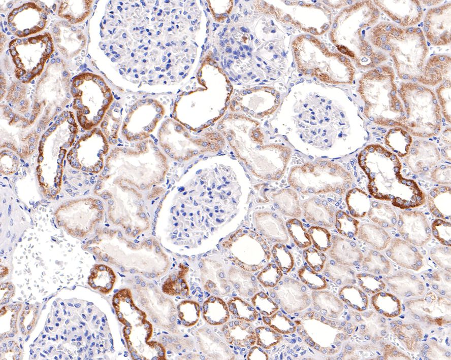 Immunohistochemical analysis of paraffin-embedded human kidney tissue with Rabbit anti-EF-Ts antibody (HA721059) at 1/100 dilution.<br />
<br />
The section was pre-treated using heat mediated antigen retrieval with Tris-EDTA buffer (pH 9.0) for 20 minutes. The tissues were blocked in 1% BSA for 20 minutes at room temperature, washed with ddH2O and PBS, and then probed with the primary antibody (HA721059) at 1/100 dilution for 1 hour at room temperature. The detection was performed using an HRP conjugated compact polymer system. DAB was used as the chromogen. Tissues were counterstained with hematoxylin and mounted with DPX.