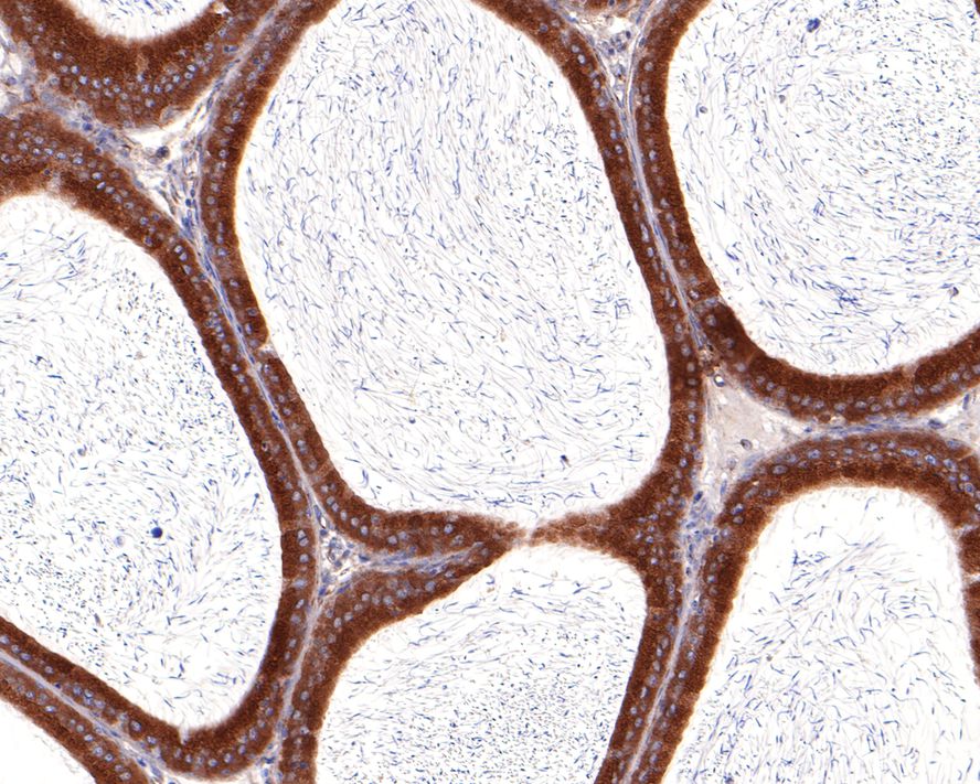 Immunohistochemical analysis of paraffin-embedded rat epididymis tissue with Rabbit anti-USO1 antibody (HA721060) at 1/100 dilution.<br />
<br />
The section was pre-treated using heat mediated antigen retrieval with Tris-EDTA buffer (pH 9.0) for 20 minutes. The tissues were blocked in 1% BSA for 20 minutes at room temperature, washed with ddH2O and PBS, and then probed with the primary antibody (HA721060) at 1/100 dilution for 1 hour at room temperature. The detection was performed using an HRP conjugated compact polymer system. DAB was used as the chromogen. Tissues were counterstained with hematoxylin and mounted with DPX.