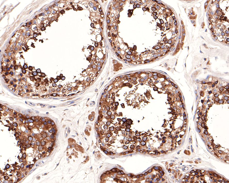 Immunohistochemical analysis of paraffin-embedded human testis tissue with Rabbit anti-USO1 antibody (HA721060) at 1/100 dilution.<br />
<br />
The section was pre-treated using heat mediated antigen retrieval with Tris-EDTA buffer (pH 9.0) for 20 minutes. The tissues were blocked in 1% BSA for 20 minutes at room temperature, washed with ddH2O and PBS, and then probed with the primary antibody (HA721060) at 1/100 dilution for 1 hour at room temperature. The detection was performed using an HRP conjugated compact polymer system. DAB was used as the chromogen. Tissues were counterstained with hematoxylin and mounted with DPX.