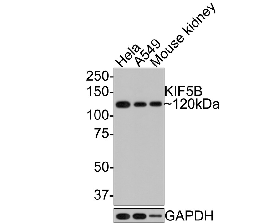 Western blot analysis of KIF5B on different lysates with Rabbit anti-KIF5B antibody at 1/500 dilution.<br />
<br />
Lane 1: HeLa cell lysate, 10 µg/Lane<br />
Lane 2: A549 cell lysate, 10 µg/Lane<br />
Lane 3: Mouse kidney tissue lysate, 20 µg/Lane<br />
<br />
Predicted band size: 110 kDa<br />
Observed band size: 110 kDa<br />
<br />
Exposure time: 1 minute;<br />
<br />
8 % SDS-PAGE gel.<br />
<br />
Proteins were transferred to a PVDF membrane and blocked with 5% NFDM/TBST for 1 hour at room temperature. The primary antibody KIF5B at 1/500 dilution was used in 5% NFDM/TBST at room temperature for 2 hours. Goat Anti-Rabbit IgG - HRP Secondary Antibody (HA1001) at 1:300,000 dilution was used for 1 hour at room temperature.