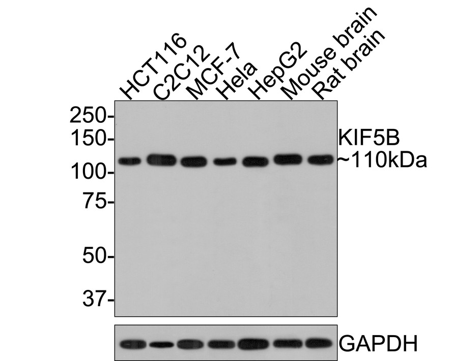 Western blot analysis of KIF5B on different lysates with Rabbit anti-KIF5B antibody at 1/500 dilution.<br />
<br />
Lane 1: HCT116 cell lysate<br />
Lane 2: C2C12 cell lysate<br />
Lane 3: MCF-7 cell lysate<br />
Lane 4: Hela cell lysate<br />
Lane 5: HepG2 cell lysate<br />
Lane 6: Mouse brain tissue lysate (20 µg/Lane)<br />
Lane 7: Rat brain tissue lysate (20 µg/Lane)<br />
<br />
Lysates/proteins at 10 µg/Lane.<br />
<br />
Predicted band size: 110 kDa<br />
Observed band size: 110 kDa<br />
<br />
Exposure time: 1 minute;<br />
<br />
8 % SDS-PAGE gel.<br />
<br />
Proteins were transferred to a PVDF membrane and blocked with 5% NFDM/TBST for 1 hour at room temperature. The primary antibody KIF5B at 1/500 dilution was used in 5% NFDM/TBST at room temperature for 2 hours. Goat Anti-Rabbit IgG - HRP Secondary Antibody (HA1001) at 1:300,000 dilution was used for 1 hour at room temperature.