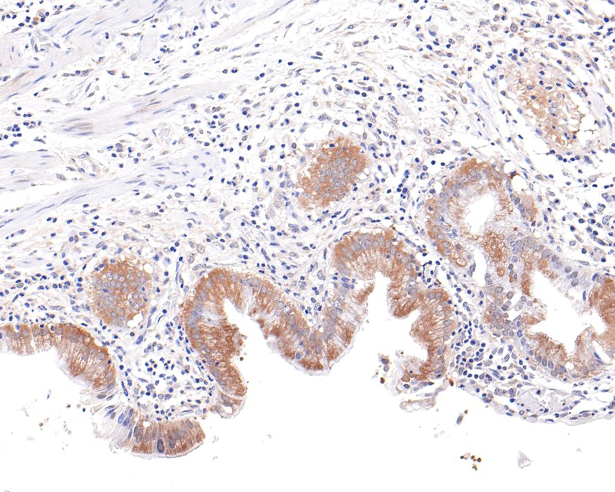 Immunohistochemical analysis of paraffin-embedded human gallbladder tissue with Rabbit anti-KIF5B antibody (HA721045) at 1/100 dilution.<br />
<br />
The section was pre-treated using heat mediated antigen retrieval with Tris-EDTA buffer (pH 9.0) for 20 minutes. The tissues were blocked in 1% BSA for 20 minutes at room temperature, washed with ddH2O and PBS, and then probed with the primary antibody KIF5B at 1/100 dilution for 1 hour at room temperature. The detection was performed using an HRP conjugated compact polymer system. DAB was used as the chromogen. Tissues were counterstained with hematoxylin and mounted with DPX.