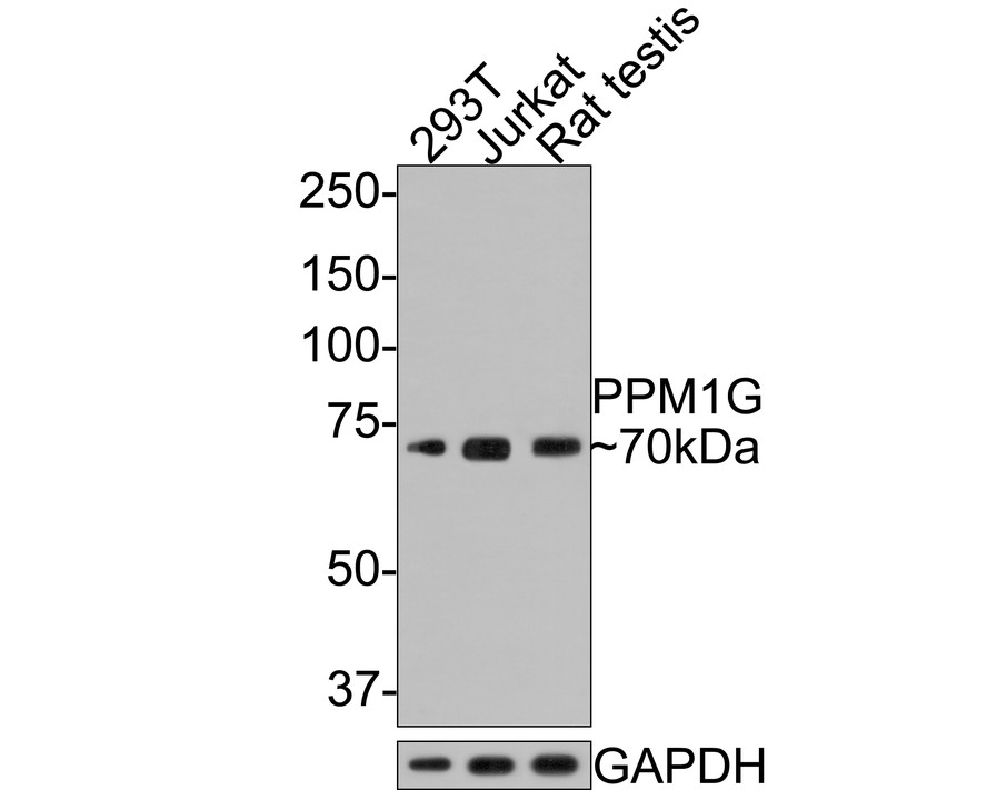 Western blot analysis of PPM1G on different lysates with Rabbit anti-PPM1G antibody (HA721046) at 1/500 dilution.<br />
<br />
Lane 1: 293T cell lysate, 10 µg/Lane<br />
Lane 2: Jurkat cell lysate, 10 µg/Lane<br />
Lane 3: Rat testis tissue lysate, 20 µg/Lane<br />
<br />
Predicted band size: 59 kDa<br />
Observed band size: 70 kDa<br />
<br />
Exposure time: 2 minutes;<br />
<br />
8% SDS-PAGE gel.<br />
<br />
Proteins were transferred to a PVDF membrane and blocked with 5% NFDM/TBST for 1 hour at room temperature. The primary antibody (HA721046) at 1/500 dilution was used in 5% NFDM/TBST at room temperature for 2 hours. Goat Anti-Rabbit IgG - HRP Secondary Antibody (HA1001) at 1:300,000 dilution was used for 1 hour at room temperature.