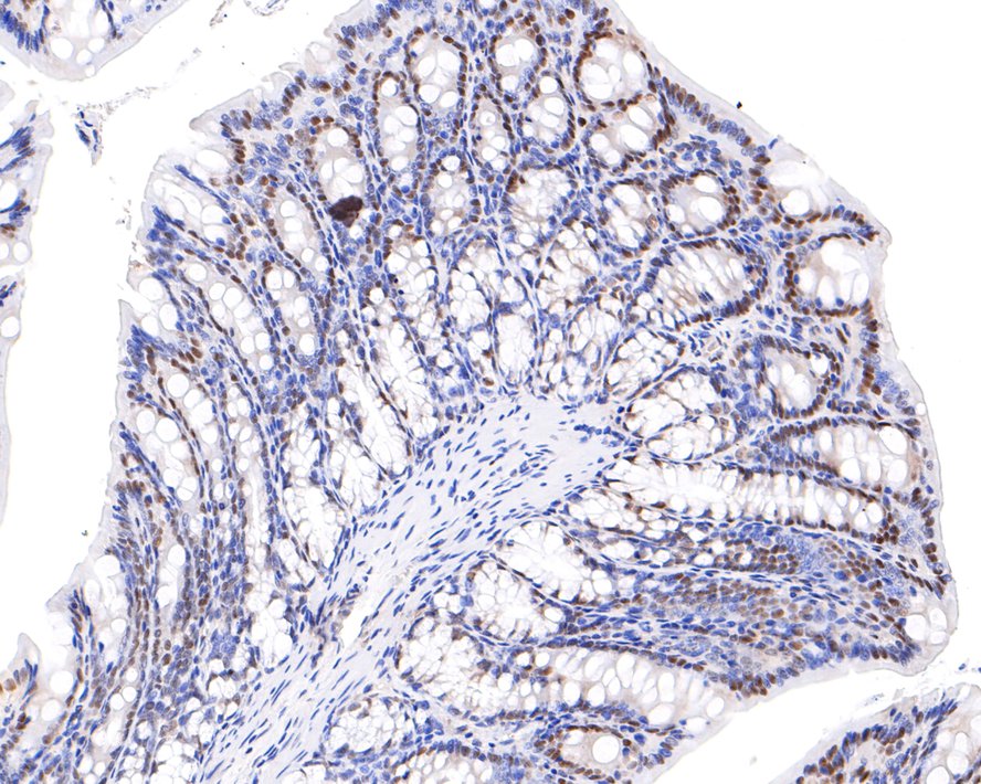 Immunohistochemical analysis of paraffin-embedded rat large intestine tissue with Rabbit anti-PPM1G antibody (HA721046) at 1/100 dilution.<br />
<br />
The section was pre-treated using heat mediated antigen retrieval with Tris-EDTA buffer (pH 9.0) for 20 minutes. The tissues were blocked in 1% BSA for 20 minutes at room temperature, washed with ddH2O and PBS, and then probed with the primary antibody (HA721046) at 1/100 dilution for 1 hour at room temperature. The detection was performed using an HRP conjugated compact polymer system. DAB was used as the chromogen. Tissues were counterstained with hematoxylin and mounted with DPX.