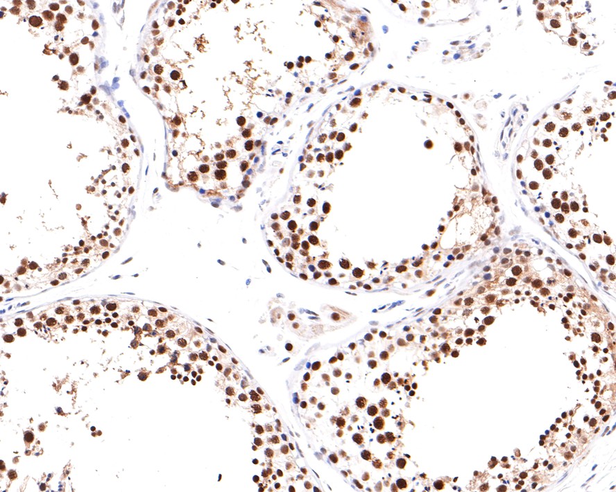Immunohistochemical analysis of paraffin-embedded human testis tissue with Rabbit anti-PPM1G antibody (HA721046) at 1/400 dilution.<br />
<br />
The section was pre-treated using heat mediated antigen retrieval with Tris-EDTA buffer (pH 9.0) for 20 minutes. The tissues were blocked in 1% BSA for 20 minutes at room temperature, washed with ddH2O and PBS, and then probed with the primary antibody (HA721046) at 1/400 dilution for 1 hour at room temperature. The detection was performed using an HRP conjugated compact polymer system. DAB was used as the chromogen. Tissues were counterstained with hematoxylin and mounted with DPX.