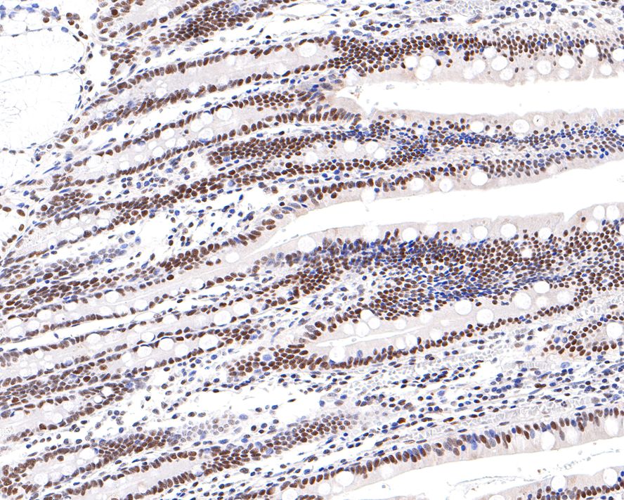 Immunohistochemical analysis of paraffin-embedded human small intestine tissue with Rabbit anti-PPM1G antibody (HA721046) at 1/400 dilution.<br />
<br />
The section was pre-treated using heat mediated antigen retrieval with Tris-EDTA buffer (pH 9.0) for 20 minutes. The tissues were blocked in 1% BSA for 20 minutes at room temperature, washed with ddH2O and PBS, and then probed with the primary antibody (HA721046) at 1/400 dilution for 1 hour at room temperature. The detection was performed using an HRP conjugated compact polymer system. DAB was used as the chromogen. Tissues were counterstained with hematoxylin and mounted with DPX.