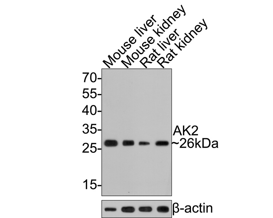 Western blot analysis of AK2 on different lysates with Rabbit anti-AK2 antibody at 1/5,000 dilution.<br />
<br />
Lane 1: Mouse liver cell lysate<br />
Lane 2: Mouse kidney cell lysate<br />
Lane 3: Rat liver cell lysate<br />
Lane 4: Rat kidney cell lysate <br />
<br />
Lysates/proteins at 20 µg/Lane.<br />
<br />
Predicted band size: 26 kDa<br />
Observed band size: 26 kDa<br />
<br />
Exposure time: 2 minutes;<br />
<br />
12 % SDS-PAGE gel.<br />
<br />
Proteins were transferred to a PVDF membrane and blocked with 5% NFDM/TBST for 1 hour at room temperature. The primary antibody AK2 at 1/5,000 dilution was used in 5% NFDM/TBST at room temperature for 2 hours. Goat Anti-Rabbit IgG - HRP Secondary Antibody (HA1001) at 1:300,000 dilution was used for 1 hour at room temperature.