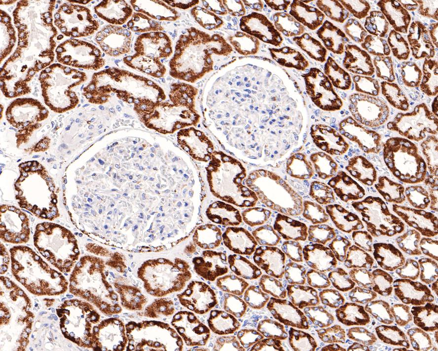Immunohistochemical analysis of paraffin-embedded human kidney tissue with Rabbit anti-AK2 antibody (HA721048) at 1/100 dilution.<br />
<br />
The section was pre-treated using heat mediated antigen retrieval with Tris-EDTA buffer (pH 9.0) for 20 minutes. The tissues were blocked in 1% BSA for 20 minutes at room temperature, washed with ddH2O and PBS, and then probed with the primary antibody AK2 at 1/100 dilution for 1 hour at room temperature. The detection was performed using an HRP conjugated compact polymer system. DAB was used as the chromogen. Tissues were counterstained with hematoxylin and mounted with DPX.