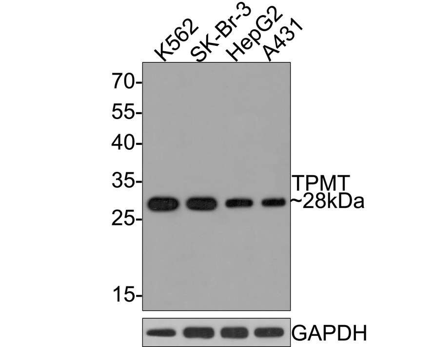 Western blot analysis of TPMT on different lysates with Rabbit anti-TPMT antibody (HA721049) at 1/500 dilution.<br />
<br />
Lane 1: K562 cell lysate<br />
Lane 2: SK-Br-3 cell lysate<br />
Lane 3: HepG2 cell lysate<br />
Lane 4: A431 cell lysate<br />
<br />
Lysates/proteins at 10 µg/Lane.<br />
<br />
Predicted band size: 28 kDa<br />
Observed band size: 28 kDa<br />
<br />
Exposure time: 2 minutes;<br />
<br />
12% SDS-PAGE gel.<br />
<br />
Proteins were transferred to a PVDF membrane and blocked with 5% NFDM/TBST for 1 hour at room temperature. The primary antibody (HA721049) at 1/500 dilution was used in 5% NFDM/TBST at room temperature for 2 hours. Goat Anti-Rabbit IgG - HRP Secondary Antibody (HA1001) at 1:300,000 dilution was used for 1 hour at room temperature.