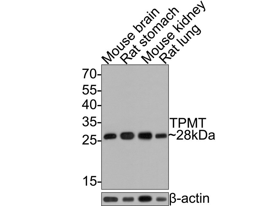 Western blot analysis of TPMT on different lysates with Rabbit anti-TPMT antibody (HA721049) at 1/500 dilution.<br />
<br />
Lane 1: Mouse brain tissue lysate<br />
Lane 2: Rat stomach tissue lysate<br />
Lane 3: Mouse kidney tissue lysate<br />
Lane 4: Rat lung tissue lysate<br />
<br />
Lysates/proteins at 20 µg/Lane.<br />
<br />
Predicted band size: 28 kDa<br />
Observed band size: 28 kDa<br />
<br />
Exposure time: 2 minutes;<br />
<br />
12% SDS-PAGE gel.<br />
<br />
Proteins were transferred to a PVDF membrane and blocked with 5% NFDM/TBST for 1 hour at room temperature. The primary antibody (HA721049) at 1/500 dilution was used in 5% NFDM/TBST at room temperature for 2 hours. Goat Anti-Rabbit IgG - HRP Secondary Antibody (HA1001) at 1:300,000 dilution was used for 1 hour at room temperature.