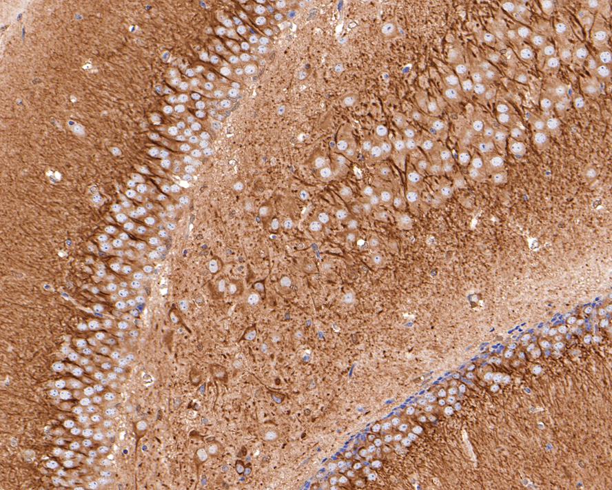 Immunohistochemical analysis of paraffin-embedded mouse hippocampus tissue with Rabbit anti-TPMT antibody (HA721049) at 1/400 dilution.<br />
<br />
The section was pre-treated using heat mediated antigen retrieval with Tris-EDTA buffer (pH 9.0) for 20 minutes. The tissues were blocked in 1% BSA for 20 minutes at room temperature, washed with ddH2O and PBS, and then probed with the primary antibody (HA721049) at 1/400 dilution for 1 hour at room temperature. The detection was performed using an HRP conjugated compact polymer system. DAB was used as the chromogen. Tissues were counterstained with hematoxylin and mounted with DPX.