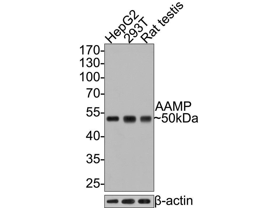Western blot analysis of AAMP on different lysates with Rabbit anti-AAMP antibody (HA721054) at 1/2,000 dilution.<br />
<br />
Lane 1: HepG2 cell lysate, 10 µg/Lane<br />
Lane 2: 293T cell lysate, 10 µg/Lane<br />
Lane 3: Rat testis tissue lysate, 20 µg/Lane<br />
<br />
Predicted band size: 47 kDa<br />
Observed band size: 50 kDa<br />
<br />
Exposure time: 1 minute;<br />
<br />
10% SDS-PAGE gel.<br />
<br />
Proteins were transferred to a PVDF membrane and blocked with 5% NFDM/TBST for 1 hour at room temperature. The primary antibody (HA721054) at 1/2,000 dilution was used in 5% NFDM/TBST at room temperature for 2 hours. Goat Anti-Rabbit IgG - HRP Secondary Antibody (HA1001) at 1:300,000 dilution was used for 1 hour at room temperature.