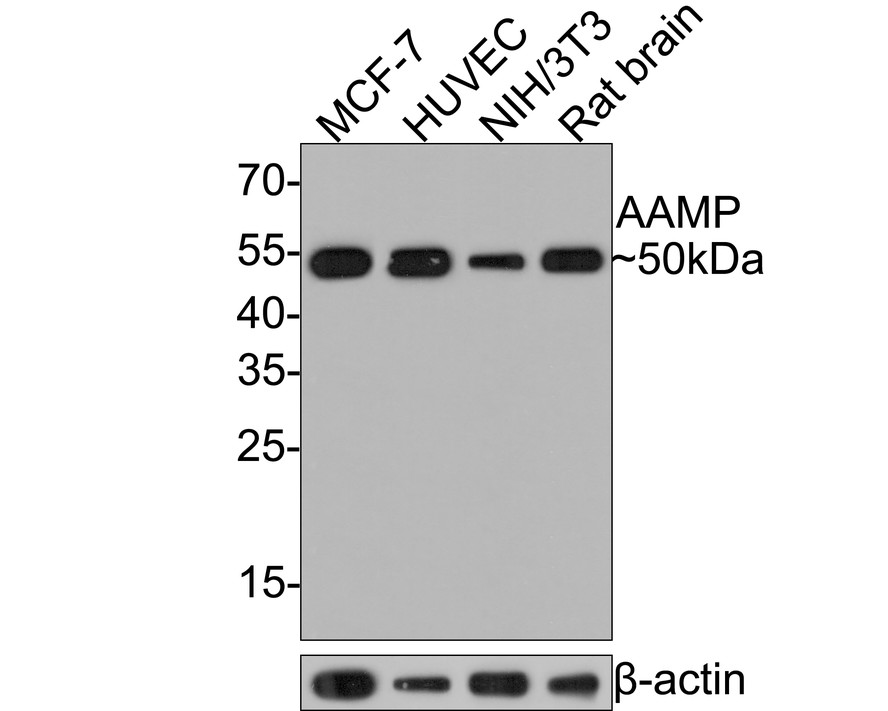 Western blot analysis of AAMP on different lysates with Rabbit anti-AAMP antibody (HA721054) at 1/500 dilution.<br />
<br />
Lane 1: MCF-7 cell lysate, 10 µg/Lane<br />
Lane 2: HUVEC cell lysate, 10 µg/Lane<br />
Lane 3: NIH/3T3 cell lysate, 10 µg/Lane<br />
Lane 4: Rat brain tissue lysate, 20 µg/Lane<br />
<br />
Predicted band size: 47 kDa<br />
Observed band size: 50 kDa<br />
<br />
Exposure time: 2 minutes;<br />
<br />
12% SDS-PAGE gel.<br />
<br />
Proteins were transferred to a PVDF membrane and blocked with 5% NFDM/TBST for 1 hour at room temperature. The primary antibody (HA721054) at 1/500 dilution was used in 5% NFDM/TBST at room temperature for 2 hours. Goat Anti-Rabbit IgG - HRP Secondary Antibody (HA1001) at 1:300,000 dilution was used for 1 hour at room temperature.