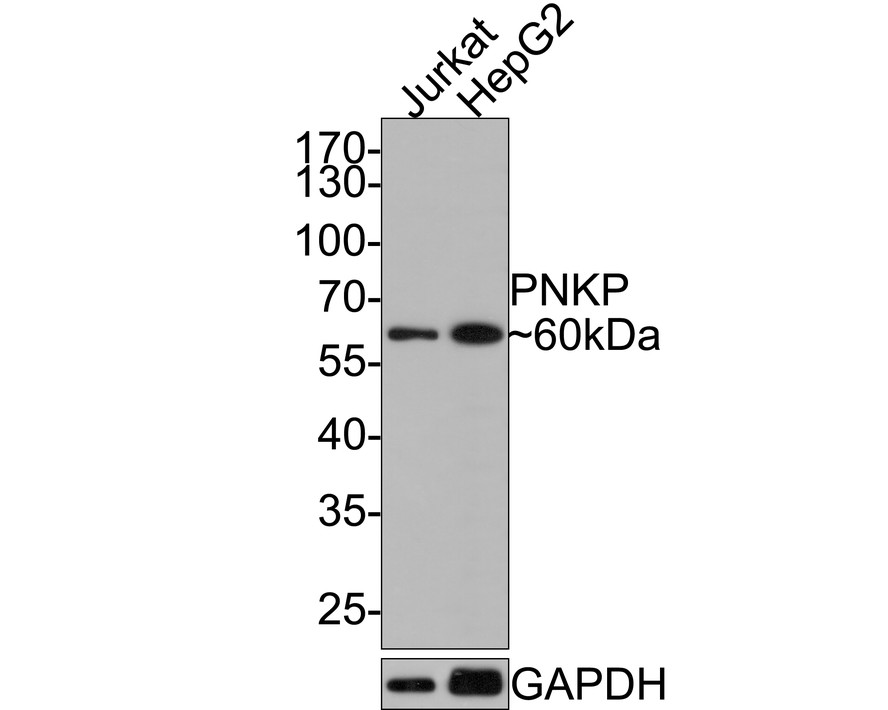 Western blot analysis of PNKP on different lysates with Rabbit anti-PNKP antibody (HA721044) at 1/1,000 dilution.<br />
<br />
Lane 1: Jurkat cell lysate<br />
Lane 2: HepG2 cell lysate<br />
<br />
Lysates/proteins at 10 µg/Lane.<br />
<br />
Predicted band size: 57 kDa<br />
Observed band size: 60 kDa<br />
<br />
Exposure time: 2 minutes;<br />
<br />
10% SDS-PAGE gel.<br />
<br />
Proteins were transferred to a PVDF membrane and blocked with 5% NFDM/TBST for 1 hour at room temperature. The primary antibody (HA721044) at 1/1,000 dilution was used in 5% NFDM/TBST at room temperature for 2 hours. Goat Anti-Rabbit IgG - HRP Secondary Antibody (HA1001) at 1:300,000 dilution was used for 1 hour at room temperature.