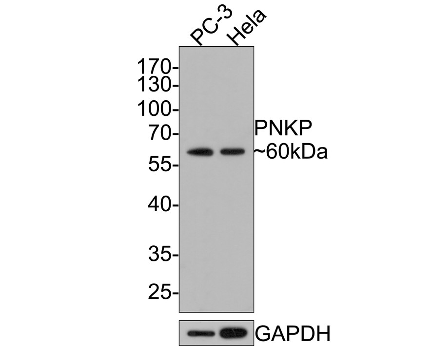 Western blot analysis of PNKP on different lysates with Rabbit anti-PNKP antibody (HA721044) at 1/500 dilution.<br />
<br />
Lane 1: PC-3 cell lysate<br />
Lane 2: Hela cell lysate<br />
<br />
Lysates/proteins at 10 µg/Lane.<br />
<br />
Predicted band size: 57 kDa<br />
Observed band size: 60 kDa<br />
<br />
Exposure time: 2 minutes;<br />
<br />
10% SDS-PAGE gel.<br />
<br />
Proteins were transferred to a PVDF membrane and blocked with 5% NFDM/TBST for 1 hour at room temperature. The primary antibody (HA721044) at 1/500 dilution was used in 5% NFDM/TBST at room temperature for 2 hours. Goat Anti-Rabbit IgG - HRP Secondary Antibody (HA1001) at 1:300,000 dilution was used for 1 hour at room temperature.