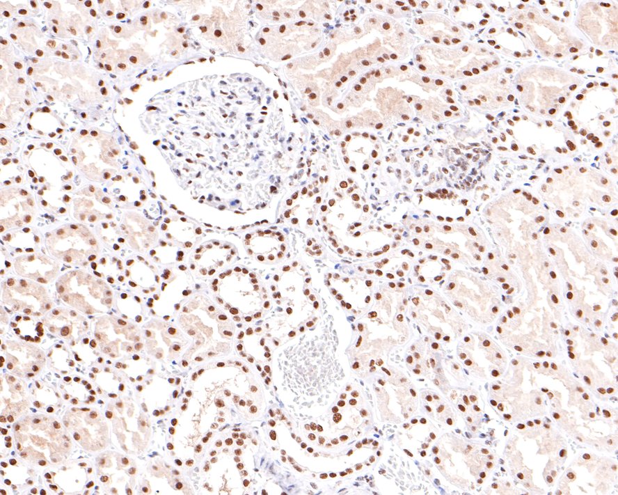 Immunohistochemical analysis of paraffin-embedded human kidney  tissue with Rabbit anti-PNKP antibody (HA721044) at 1/400 dilution.<br />
<br />
The section was pre-treated using heat mediated antigen retrieval with sodium citrate buffer (pH 6.0) for 2 minutes. The tissues were blocked in 1% BSA for 20 minutes at room temperature, washed with ddH2O and PBS, and then probed with the primary antibody (HA721044) at 1/400 dilution for 1 hour at room temperature. The detection was performed using an HRP conjugated compact polymer system. DAB was used as the chromogen. Tissues were counterstained with hematoxylin and mounted with DPX.