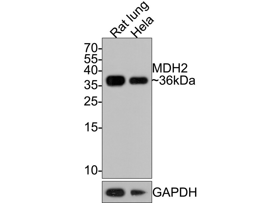 Western blot analysis of MDH2 on different lysates with Rabbit anti-MDH2 antibody (HA721043) at 1/500 dilution.<br />
<br />
Lane 1: Rat lung tissue lysate (20 µg/Lane)<br />
Lane 2: Hela cell lysate <br />
<br />
Lysates/proteins at 10 µg/Lane.<br />
<br />
Predicted band size: 36 kDa<br />
Observed band size: 36 kDa<br />
<br />
Exposure time: 1 minute;<br />
<br />
15% SDS-PAGE gel.<br />
<br />
Proteins were transferred to a PVDF membrane and blocked with 5% NFDM/TBST for 1 hour at room temperature. The primary antibody (HA721043) at 1/500 dilution was used in 5% NFDM/TBST at room temperature for 2 hours. Goat Anti-Rabbit IgG - HRP Secondary Antibody (HA1001) at 1:300,000 dilution was used for 1 hour at room temperature.