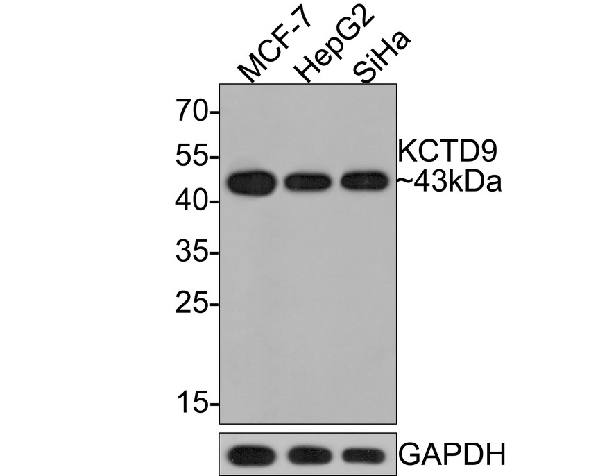 Western blot analysis of KCTD9 on different lysates with Rabbit anti-KCTD9 antibody (HA721042) at 1/500 dilution.<br />
<br />
Lane 1: MCF-7 cell lysate<br />
Lane 2: HepG2 cell lysate<br />
Lane 3: SiHa cell lysate<br />
<br />
Lysates/proteins at 10 µg/Lane.<br />
<br />
Predicted band size: 43 kDa<br />
Observed band size: 43 kDa<br />
<br />
Exposure time: 30 seconds;<br />
<br />
12% SDS-PAGE gel.<br />
<br />
Proteins were transferred to a PVDF membrane and blocked with 5% NFDM/TBST for 1 hour at room temperature. The primary antibody (HA721042) at 1/500 dilution was used in 5% NFDM/TBST at room temperature for 2 hours. Goat Anti-Rabbit IgG - HRP Secondary Antibody (HA1001) at 1:300,000 dilution was used for 1 hour at room temperature.