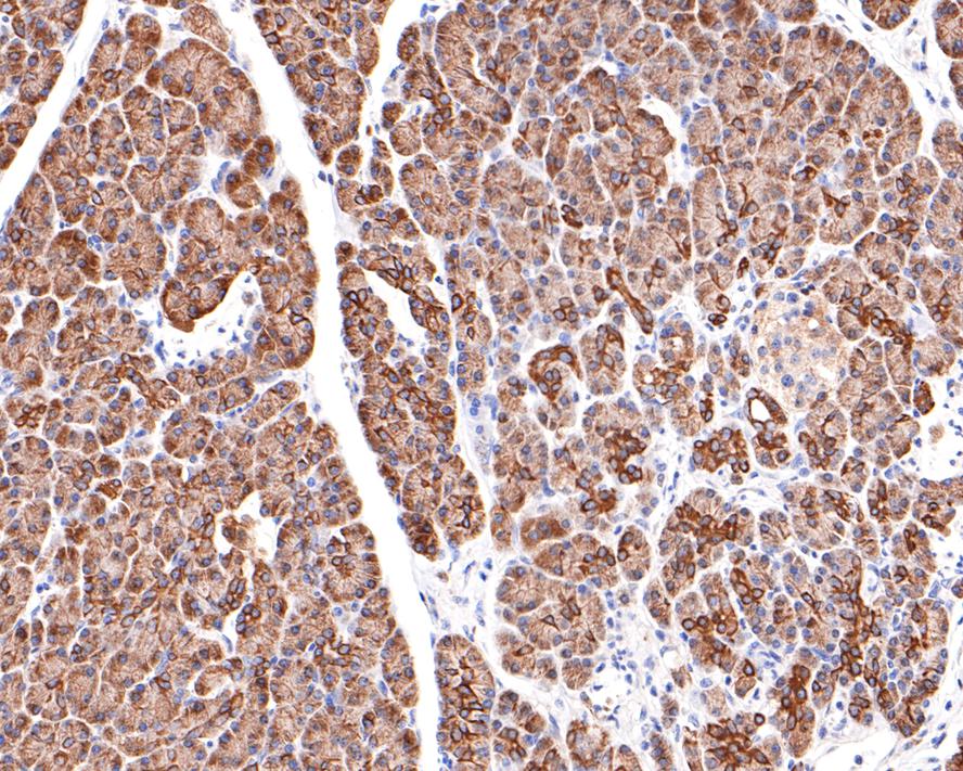 Immunohistochemical analysis of paraffin-embedded human pancreas tissue with Rabbit anti-KCTD9 antibody (HA721042) at 1/400 dilution.<br />
<br />
The section was pre-treated using heat mediated antigen retrieval with Tris-EDTA buffer (pH 9.0) for 20 minutes. The tissues were blocked in 1% BSA for 20 minutes at room temperature, washed with ddH2O and PBS, and then probed with the primary antibody (HA721042) at 1/400 dilution for 1 hour at room temperature. The detection was performed using an HRP conjugated compact polymer system. DAB was used as the chromogen. Tissues were counterstained with hematoxylin and mounted with DPX.