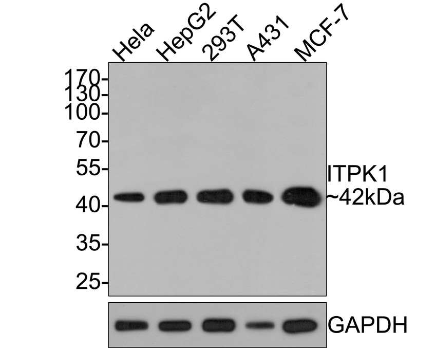 Western blot analysis of ITPK1 on different lysates with Rabbit anti-ITPK1 antibody (HA721039) at 1/500 dilution.<br />
<br />
Lane 1: Hela cell lysate<br />
Lane 2: HepG2 cell lysate<br />
Lane 3: 293T cell lysate<br />
Lane 4: A431 cell lysate<br />
Lane 5: MCF-7 cell lysate<br />
<br />
Lysates/proteins at 10 µg/Lane.<br />
<br />
Predicted band size: 46 kDa<br />
Observed band size: 42 kDa<br />
<br />
Exposure time: 2 minutes;<br />
<br />
10% SDS-PAGE gel.<br />
<br />
Proteins were transferred to a PVDF membrane and blocked with 5% NFDM/TBST for 1 hour at room temperature. The primary antibody (HA721039) at 1/500 dilution was used in 5% NFDM/TBST at room temperature for 2 hours. Goat Anti-Rabbit IgG - HRP Secondary Antibody (HA1001) at 1:300,000 dilution was used for 1 hour at room temperature.