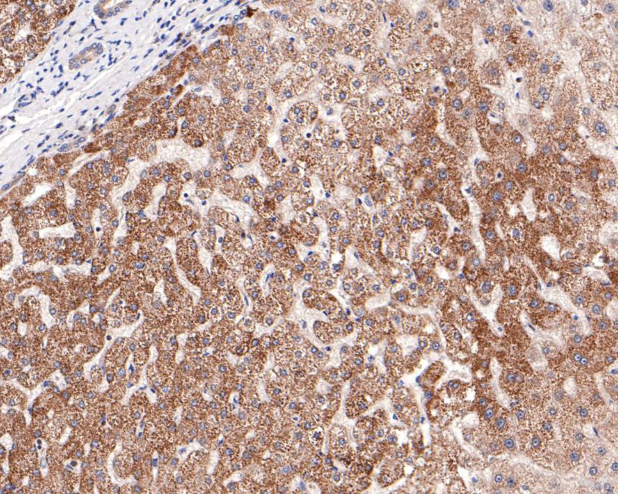 Immunohistochemical analysis of paraffin-embedded human liver tissue with Rabbit anti-ITPK1 antibody (HA721039) at 1/100 dilution.<br />
<br />
The section was pre-treated using heat mediated antigen retrieval with Tris-EDTA buffer (pH 9.0) for 20 minutes. The tissues were blocked in 1% BSA for 20 minutes at room temperature, washed with ddH2O and PBS, and then probed with the primary antibody (HA721039) at 1/100 dilution for 1 hour at room temperature. The detection was performed using an HRP conjugated compact polymer system. DAB was used as the chromogen. Tissues were counterstained with hematoxylin and mounted with DPX.