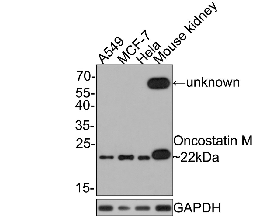 Western blot analysis of Oncostatin M on different lysates with Rabbit anti-Oncostatin M antibody (HA721038) at 1/500 dilution.<br />
<br />
Lane 1: A549 cell lysate<br />
Lane 2: MCF-7 cell lysate<br />
Lane 3: Hela cell lysate<br />
Lane 4: Mouse kidney tissue lysate (20 µg/Lane)<br />
<br />
Lysates/proteins at 10 µg/Lane.<br />
<br />
Predicted band size: 28 kDa<br />
Observed band size: 22 kDa<br />
<br />
Exposure time: 2 minutes;<br />
<br />
12% SDS-PAGE gel.<br />
<br />
Proteins were transferred to a PVDF membrane and blocked with 5% NFDM/TBST for 1 hour at room temperature. The primary antibody (HA721038) at 1/500 dilution was used in 5% NFDM/TBST at room temperature for 2 hours. Goat Anti-Rabbit IgG - HRP Secondary Antibody (HA1001) at 1:300,000 dilution was used for 1 hour at room temperature.