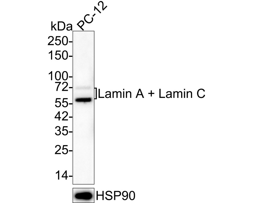 Immunohistochemical analysis of paraffin-embedded human skin tissue with Mouse anti-Lamin A + Lamin C antibody (HA600093) at 1/600 dilution.<br />
<br />
The section was pre-treated using heat mediated antigen retrieval with sodium citrate buffer (pH 6.0) for 2 minutes. The tissues were blocked in 1% BSA for 20 minutes at room temperature, washed with ddH2O and PBS, and then probed with the primary antibody (HA600093) at 1/600 dilution for 1 hour at room temperature. The detection was performed using an HRP conjugated compact polymer system. DAB was used as the chromogen. Tissues were counterstained with hematoxylin and mounted with DPX.