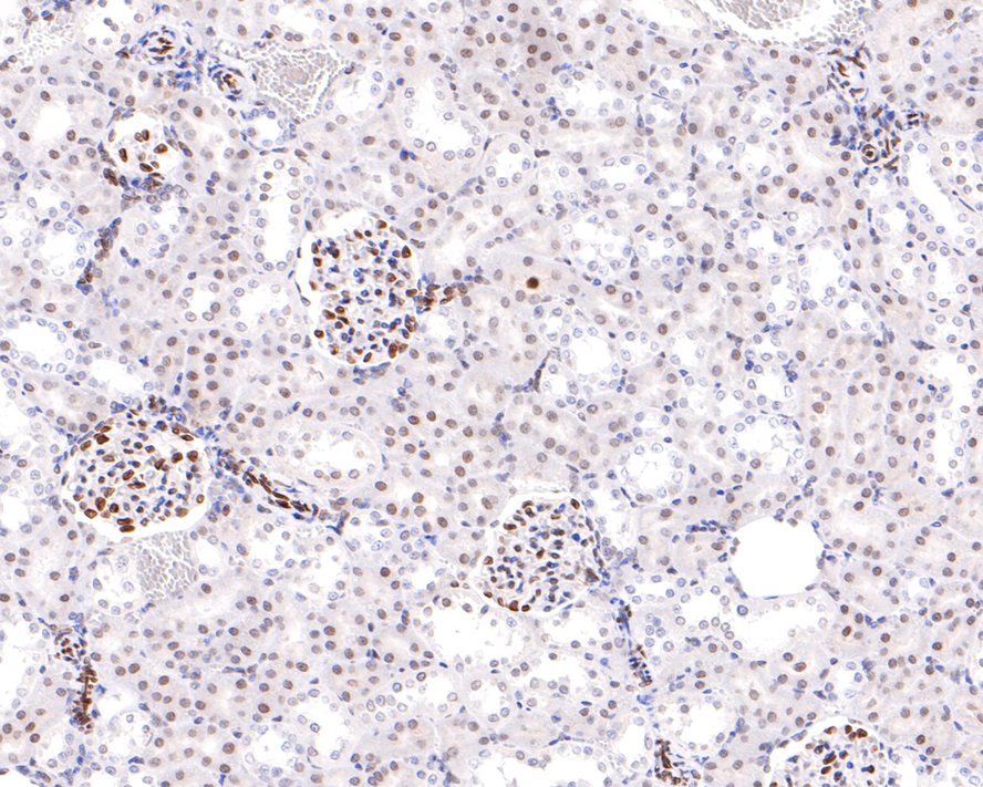 Immunohistochemical analysis of paraffin-embedded rat heart tissue with Rabbit anti-Lamin A + Lamin C antibody (HA600093) at 1/500 dilution.<br />
<br />
The section was pre-treated using heat mediated antigen retrieval with sodium citrate buffer (pH 6.0) for 2 minutes. The tissues were blocked in 1% BSA for 20 minutes at room temperature, washed with ddH2O and PBS, and then probed with the primary antibody (HA600093) at 1/500 dilution for 1 hour at room temperature. The detection was performed using an HRP conjugated compact polymer system. DAB was used as the chromogen. Tissues were counterstained with hematoxylin and mounted with DPX.