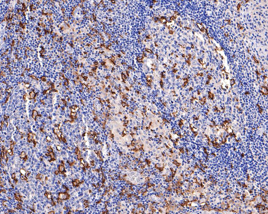 Immunohistochemical analysis of paraffin-embedded human lymph nodes tissue with Rabbit anti-CD11c antibody (ET1606-19) at 1/400 dilution.<br />
<br />
The section was pre-treated using heat mediated antigen retrieval with Tris-EDTA buffer (pH 9.0) for 20 minutes. The tissues were blocked in 1% BSA for 20 minutes at room temperature, washed with ddH2O and PBS, and then probed with the primary antibody (ET1606-19) at 1/400 dilution for 1 hour at room temperature. The detection was performed using an HRP conjugated compact polymer system. DAB was used as the chromogen. Tissues were counterstained with hematoxylin and mounted with DPX.