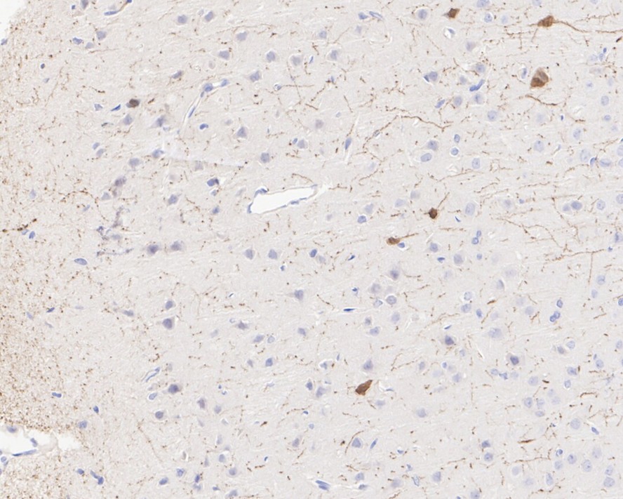 Immunohistochemical analysis of paraffin-embedded rat brain tissue with Rabbit anti-Calretinin antibody (ET1705-19) at 1/5,000 dilution.<br />
<br />
The section was pre-treated using heat mediated antigen retrieval with Tris-EDTA buffer (pH 9.0) for 20 minutes. The tissues were blocked in 1% BSA for 20 minutes at room temperature, washed with ddH2O and PBS, and then probed with the primary antibody (ET1705-19) at 1/5,000 dilution for 1 hour at room temperature. The detection was performed using an HRP conjugated compact polymer system. DAB was used as the chromogen. Tissues were counterstained with hematoxylin and mounted with DPX.