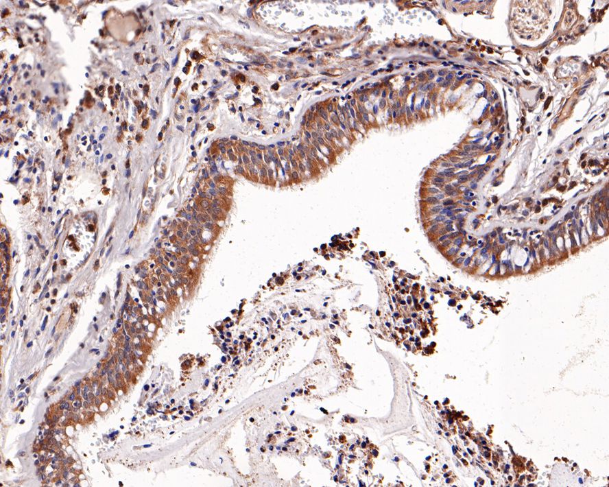 Immunohistochemical analysis of paraffin-embedded human trachea tissue with Rabbit anti-SCGB1A1 antibody (ET7106-71) at 1/1,000 dilution.<br />
<br />
The section was pre-treated using heat mediated antigen retrieval with Tris-EDTA buffer (pH 9.0) for 20 minutes. The tissues were blocked in 1% BSA for 20 minutes at room temperature, washed with ddH2O and PBS, and then probed with the primary antibody (ET7106-71) at 1/1,000 dilution for 1 hour at room temperature. The detection was performed using an HRP conjugated compact polymer system. DAB was used as the chromogen. Tissues were counterstained with hematoxylin and mounted with DPX.