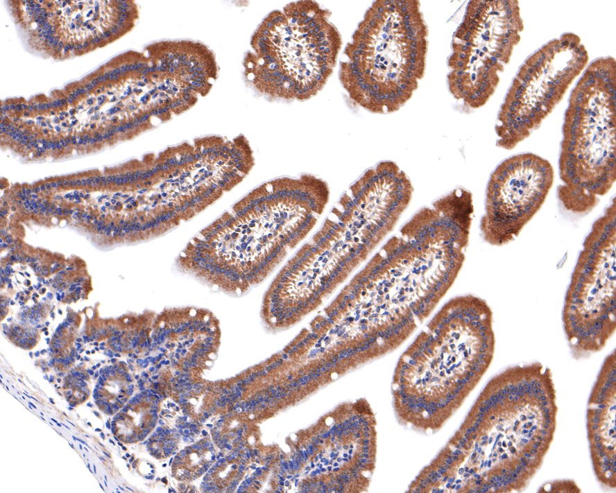 Immunohistochemical analysis of paraffin-embedded mouse small intestine tissue with Rabbit anti-GIT1 antibody (ET7106-91) at 1/400 dilution.<br />
<br />
The section was pre-treated using heat mediated antigen retrieval with Tris-EDTA buffer (pH 9.0) for 20 minutes. The tissues were blocked in 1% BSA for 20 minutes at room temperature, washed with ddH2O and PBS, and then probed with the primary antibody (ET7106-91) at 1/400 dilution for 1 hour at room temperature. The detection was performed using an HRP conjugated compact polymer system. DAB was used as the chromogen. Tissues were counterstained with hematoxylin and mounted with DPX.