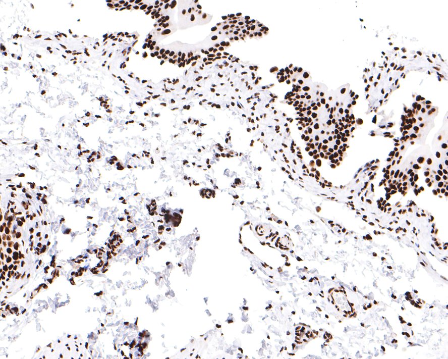 Immunohistochemical analysis of paraffin-embedded rat bladder tissue with Rabbit anti-SMC1 antibody (ET1611-97) at 1/100 dilution.<br />
<br />
The section was pre-treated using heat mediated antigen retrieval with sodium citrate buffer (pH 6.0) for 2 minutes. The tissues were blocked in 1% BSA for 20 minutes at room temperature, washed with ddH2O and PBS, and then probed with the primary antibody (ET1611-97) at 1/100 dilution for 1 hour at room temperature. The detection was performed using an HRP conjugated compact polymer system. DAB was used as the chromogen. Tissues were counterstained with hematoxylin and mounted with DPX.