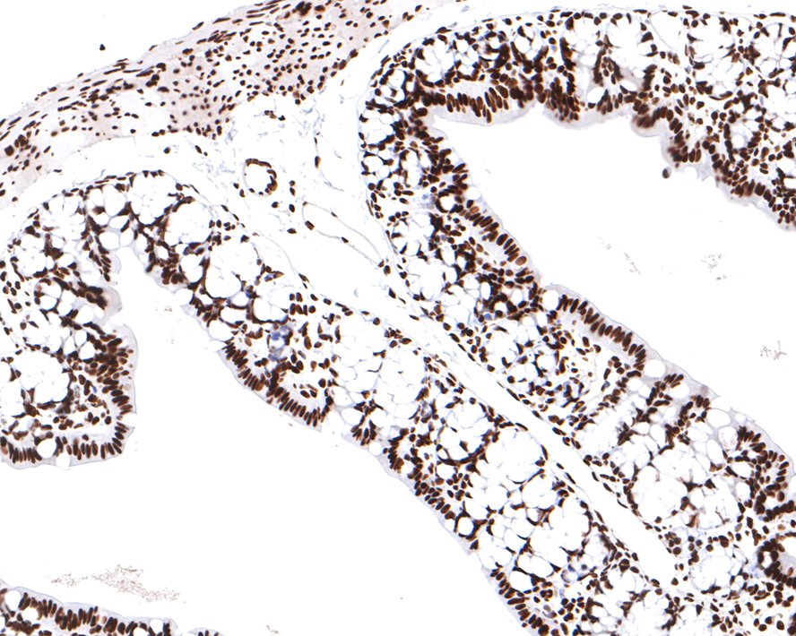 Immunohistochemical analysis of paraffin-embedded rat large intestine tissue with Rabbit anti-SMC1 antibody (ET1611-97) at 1/400 dilution.<br />
<br />
The section was pre-treated using heat mediated antigen retrieval with sodium citrate buffer (pH 6.0) for 2 minutes. The tissues were blocked in 1% BSA for 20 minutes at room temperature, washed with ddH2O and PBS, and then probed with the primary antibody (ET1611-97) at 1/400 dilution for 1 hour at room temperature. The detection was performed using an HRP conjugated compact polymer system. DAB was used as the chromogen. Tissues were counterstained with hematoxylin and mounted with DPX.