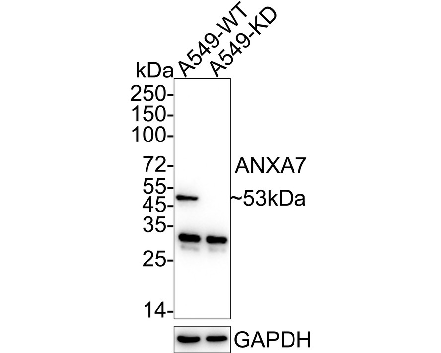 Western blot analysis of ANXA7 on different lysates with Rabbit anti-ANXA7 antibody (HA721068) at 1/500 dilution.<br />
<br />
Lane 1: 293T cell lysate<br />
Lane 2: A431 cell lysate<br />
Lane 1: Hela cell lysate<br />
Lane 2: HepG2 cell lysate<br />
<br />
<br />
Lysates/proteins at 10 µg/Lane.<br />
<br />
Predicted band size: 53 kDa<br />
Observed band size: 53 kDa<br />
<br />
Exposure time: 1 minute;<br />
<br />
10% SDS-PAGE gel.<br />
<br />
Proteins were transferred to a PVDF membrane and blocked with 5% NFDM/TBST for 1 hour at room temperature. The primary antibody (HA721068) at 1/500 dilution was used in 5% NFDM/TBST at room temperature for 2 hours. Goat Anti-Rabbit IgG - HRP Secondary Antibody (HA1001) at 1:300,000 dilution was used for 1 hour at room temperature.