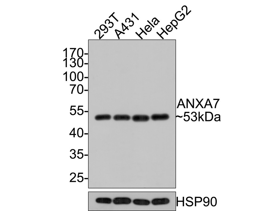 Western blot analysis of ANXA7 on NIH/3T3 cell lysates with Rabbit anti-ANXA7 antibody (HA721068) at 1/500 dilution.<br />
<br />
Lysates/proteins at 10 µg/Lane.<br />
<br />
Predicted band size: 53 kDa<br />
Observed band size: 53 kDa<br />
<br />
Exposure time: 30 seconds;<br />
<br />
12% SDS-PAGE gel.<br />
<br />
Proteins were transferred to a PVDF membrane and blocked with 5% NFDM/TBST for 1 hour at room temperature. The primary antibody (HA721068) at 1/500 dilution was used in 5% NFDM/TBST at room temperature for 2 hours. Goat Anti-Rabbit IgG - HRP Secondary Antibody (HA1001) at 1:300,000 dilution was used for 1 hour at room temperature.