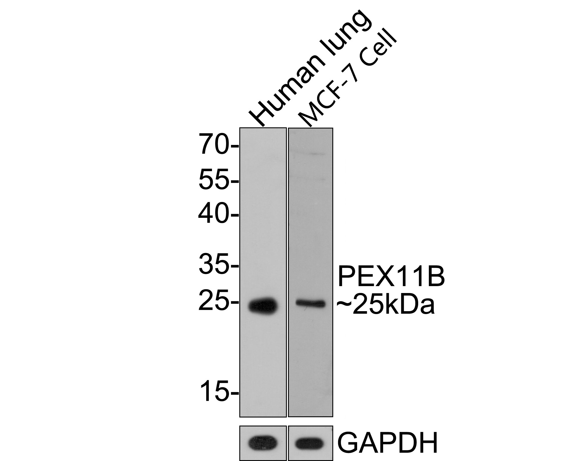 Western blot analysis of PEX11B on different lysates with Rabbit anti-PEX11B antibody (HA721124) at 1/500 dilution.<br />
<br />
Lane 1: Human lung tissue lysate, 20 µg/Lane<br />
Lane 2: MCF-7 cell lysate, 10 µg/Lane.<br />
<br />
Predicted band size: 28 kDa<br />
Observed band size: 25 kDa<br />
<br />
Exposure time: 1 minute;<br />
<br />
12% SDS-PAGE gel.<br />
<br />
Proteins were transferred to a PVDF membrane and blocked with 5% NFDM/TBST for 1 hour at room temperature. The primary antibody (HA721124) at 1/500 dilution was used in 5% NFDM/TBST at room temperature for 2 hours. Goat Anti-Rabbit IgG - HRP Secondary Antibody (HA1001) at 1:300,000 dilution was used for 1 hour at room temperature.